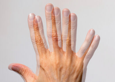 Close-up of an eye showing blurred or double vision, representing double vision (diplopia).