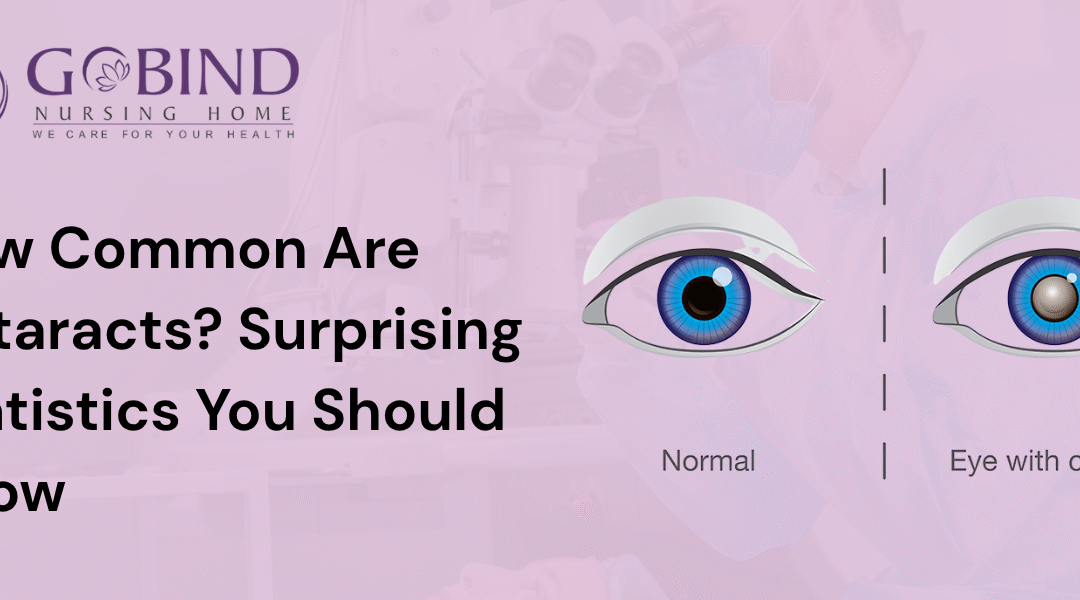Infographic showing cataract prevalence statistics worldwide, highlighting how common cataracts is.