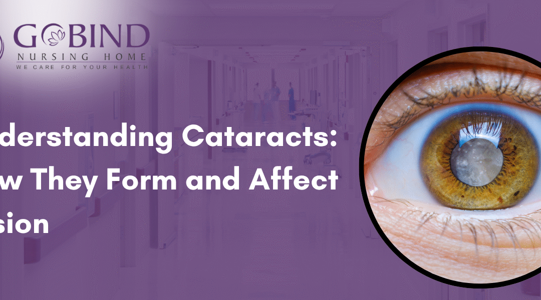Understanding cataracts and how they form in the eye.