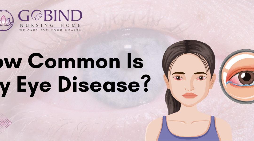 Dry eye disease is more common than you think—affecting millions across all age groups.