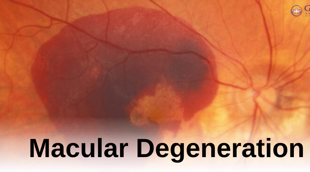 Illustration explaining macular degeneration and how it affects central detailed vision
