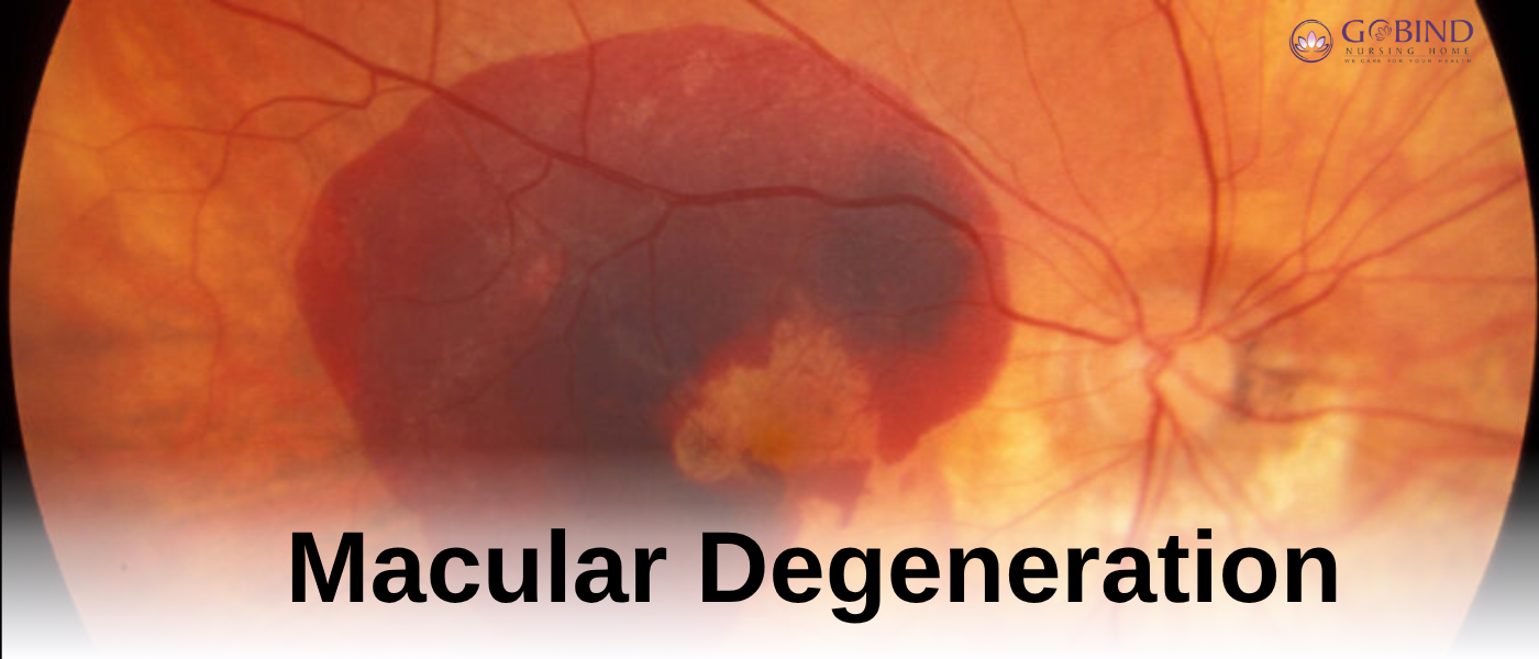 Illustration explaining macular degeneration and how it affects central detailed vision