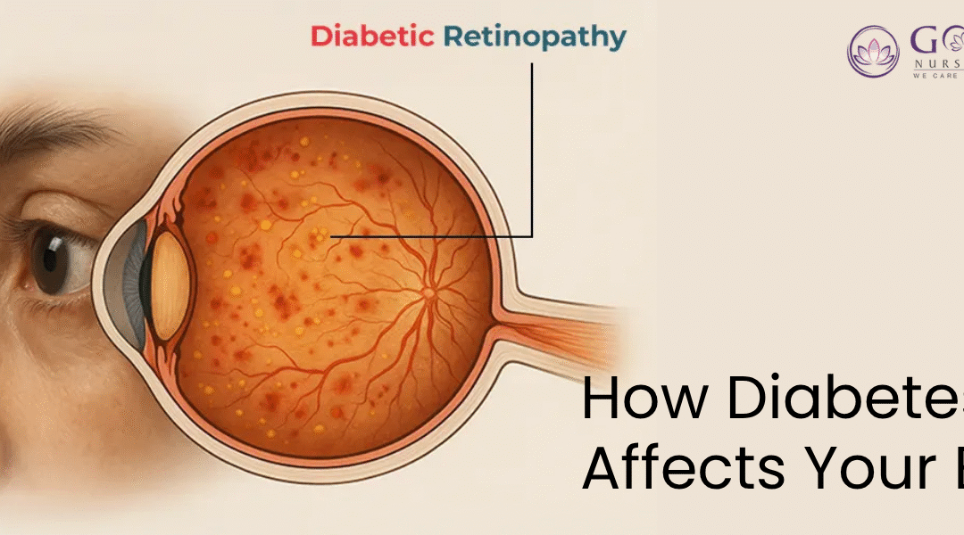 Diabetic Retinopathy: How Diabetes Affects Your Eyes and What You Can Do | Gobind Eye Care