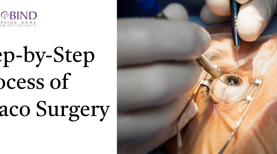 Step-by-Step Process of Phaco Surgery Explained 