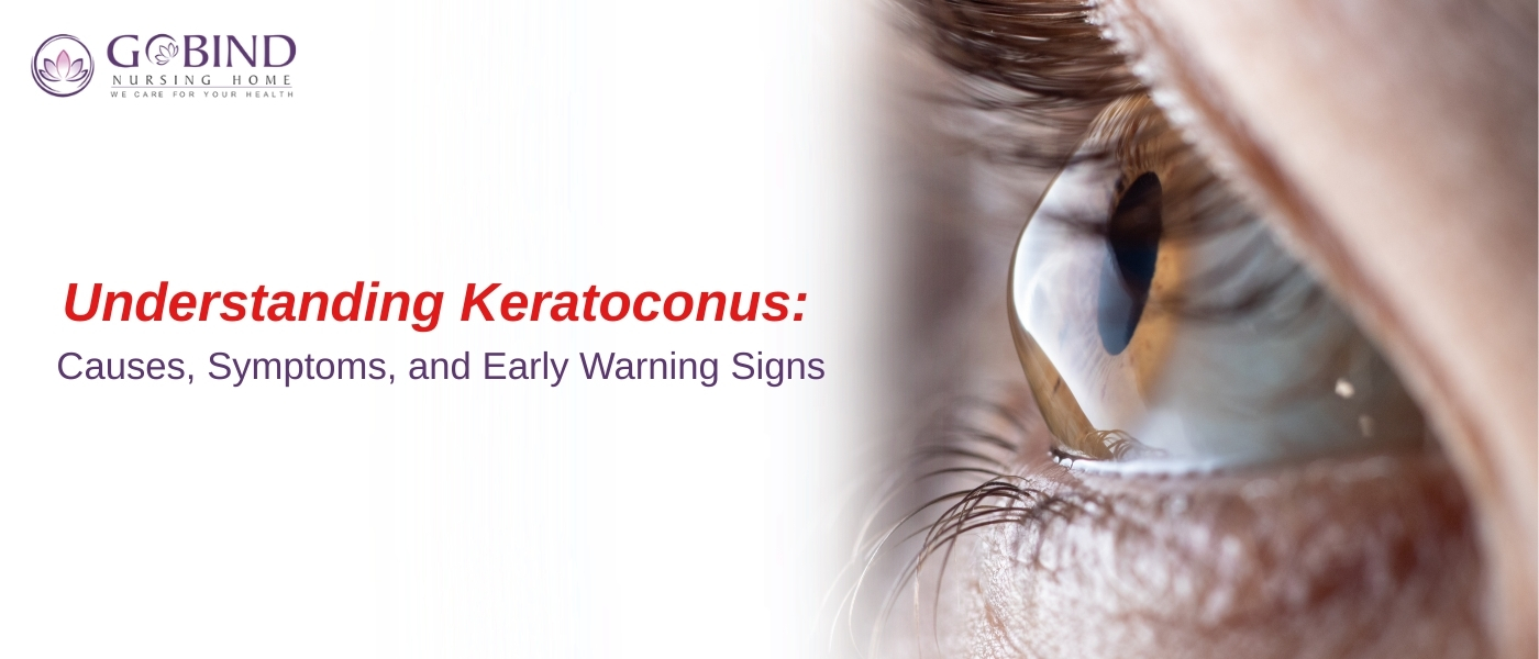 Close-up image of an eye showing corneal bulging, representing keratoconus, with text reading ‘Understanding Keratoconus: Causes, Symptoms, and Early Warning Signs’ for Gobind Eye Care.
