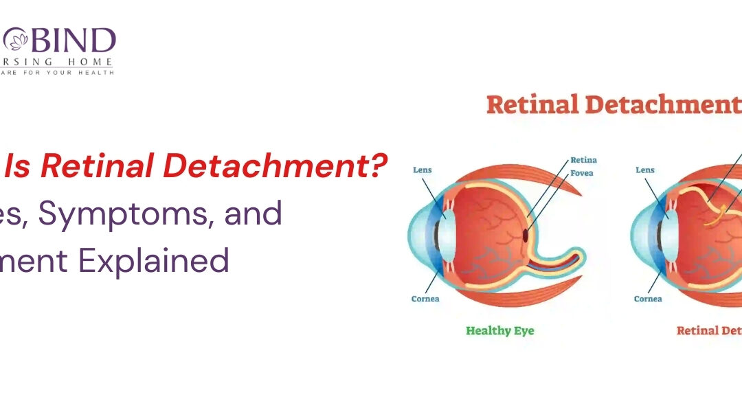 "Retinal detachment illustration showing healthy eye vs detached retina with tears, used for explaining causes, symptoms, and treatment by Dr. Maneesh Dhupper – Gobind Eye Care."