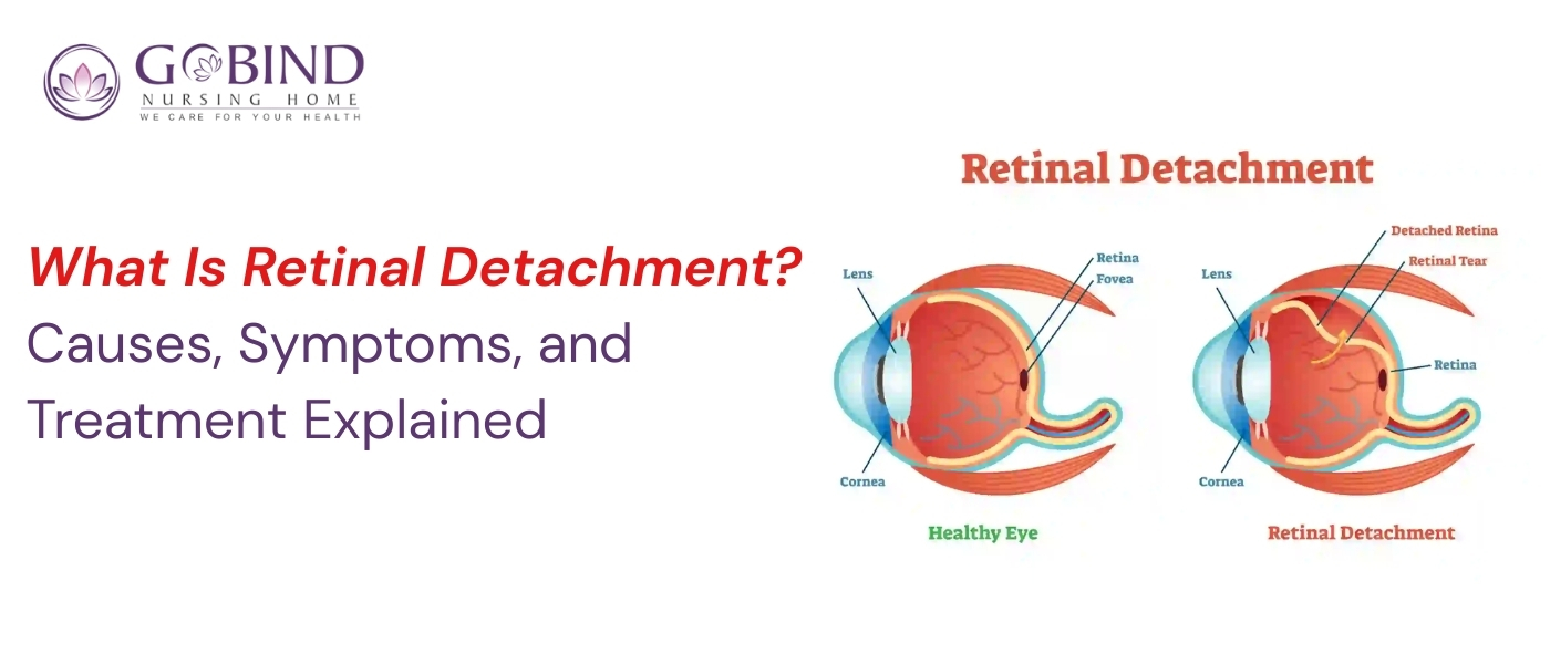 "Retinal detachment illustration showing healthy eye vs detached retina with tears, used for explaining causes, symptoms, and treatment by Dr. Maneesh Dhupper – Gobind Eye Care."