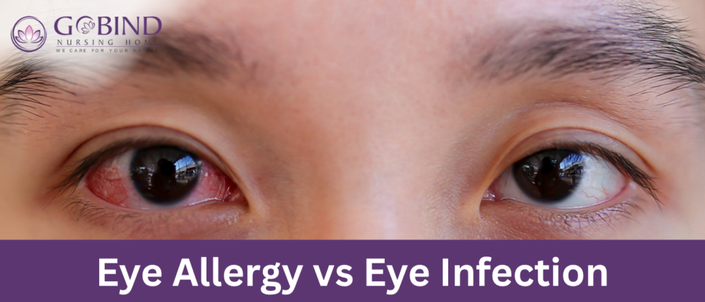 Red, itchy, or watery eyes can signal either an eye allergy or an eye infection but distinguishing between them is crucial for proper treatment.
