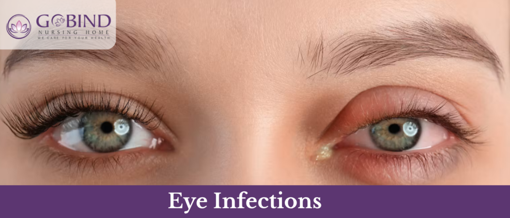 Various infections affecting different parts of the eye can cause significant discomfort.