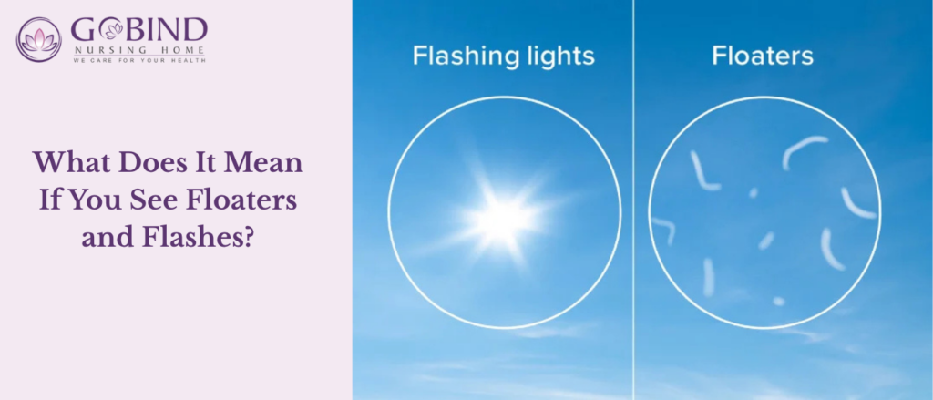 Many people experience floaters and flashes at some point in their lives.