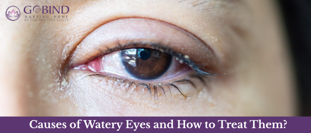 Watery eyes may seem like a minor problem, but frequent or excessive tearing can sometimes indicate an underlying eye condition.