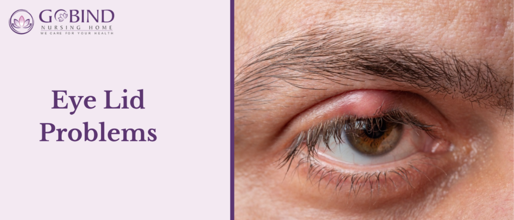The eyelids play an important role in spreading tears across the surface of the eye and directing them toward the drainage system.