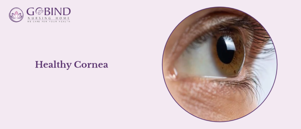 healthy cornea
