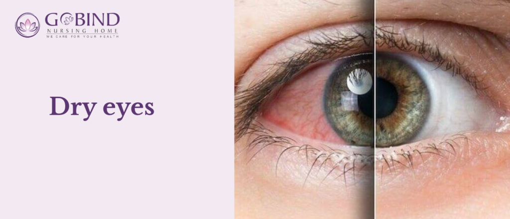 dry eyes